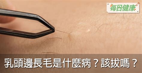 乳暈生毛|乳頭邊長了毛，是什麼病？該不該拔？讓名醫一次解釋給您聽｜每